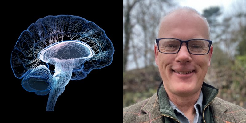 Brain scan and Professor Alasdair Coles